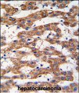 IHC-P