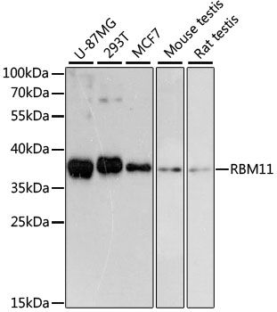 Western blot - RBM11 antibody (144-013216)