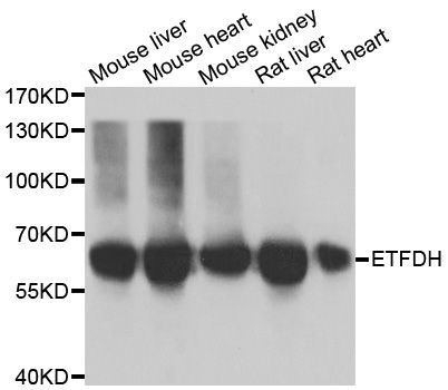 Western blot - ETFDH antibody (144-06585)