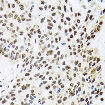 Immunohistochemistry - FUBP1 Polyclonal Antibody (144-05587)