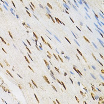 Immunohistochemistry - KPNA4 Antibody (144-02026)