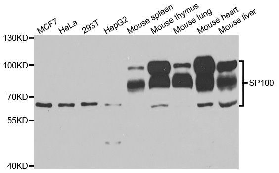 Western blot - SP100 antibody (144-05851)