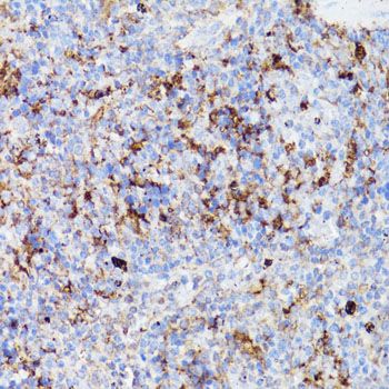 Immunohistochemistry - CD4 Polyclonal Antibody (144-60019)