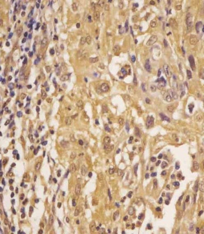 IHC-P
