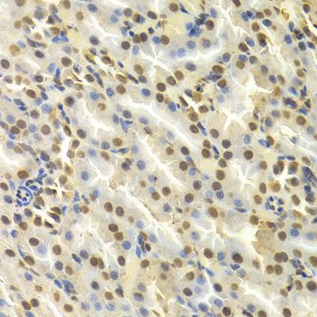 Immunohistochemistry - DCK antibody (144-01794)