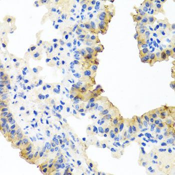 Immunohistochemistry - FECH antibody (144-08418)