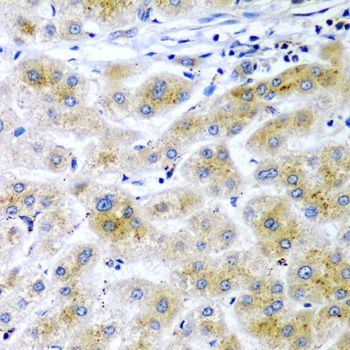 Immunohistochemistry - RARRES2 antibody (144-06963)