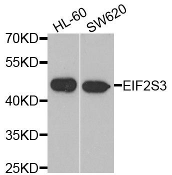Western blot - EIF2S3 antibody (144-06581)
