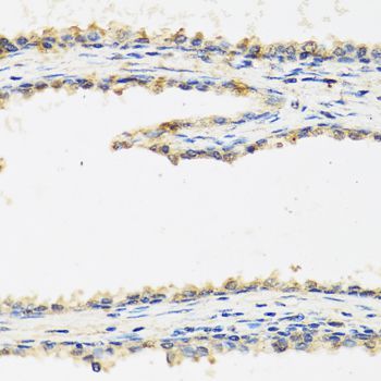 Immunohistochemistry - SPINT1 antibody (144-06411)