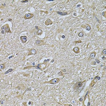 Immunohistochemistry - WIPI1 Polyclonal Antibody (144-07528)