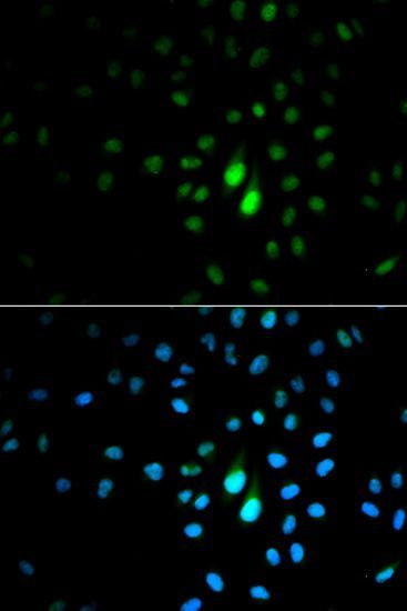 Immunofluorescence - PIN1 Polyclonal Antibody (144-60435)