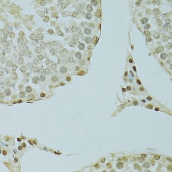 Immunohistochemistry - SAFB antibody (144-07927)