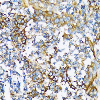 Immunohistochemistry - NFKB1 Polyclonal Antibody (144-11160)