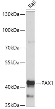 Western blot