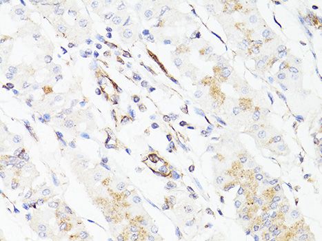 Immunohistochemistry - VIM Polyclonal Antibody (144-011952)