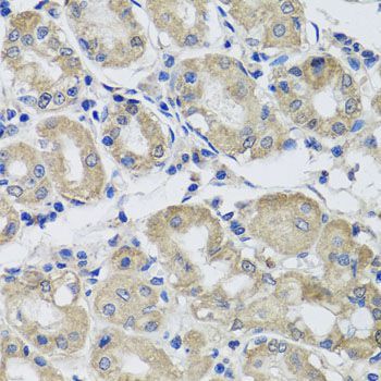 Immunohistochemistry - ST8SIA2 antibody (144-07748)