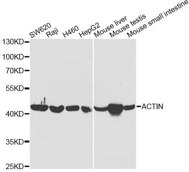 Western blot - ACAT1 Polyclonal Antibody (144-60258)