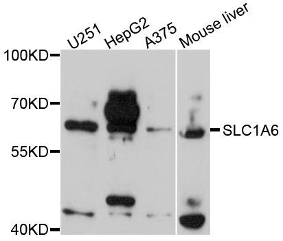 Western blot - SLC1A6 antibody (144-02904)