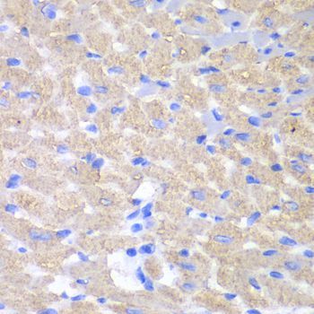 Immunohistochemistry - GPAM antibody (144-06610)