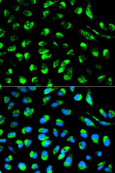 Immunofluorescence - ECI1 antibody (144-01211)