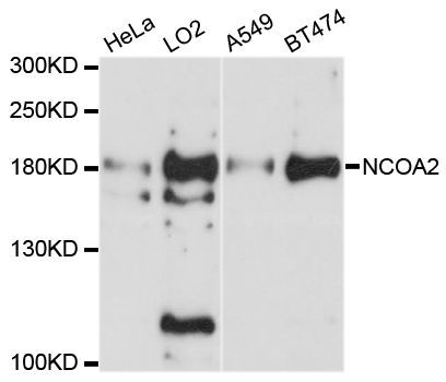 Western blot - [KO Validated] NCOA2 Polyclonal Antibody (144-10280)