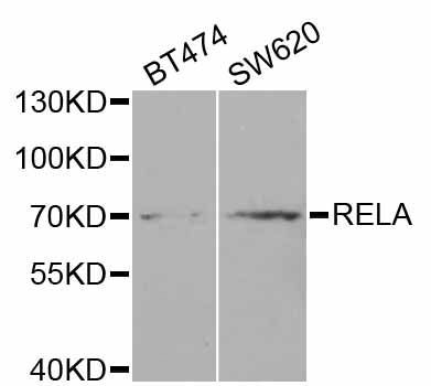 Western blot - RELA Polyclonal Antibody (144-02547)