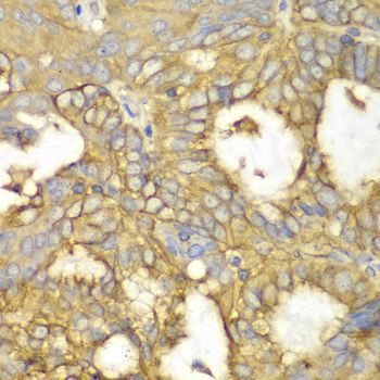 Immunohistochemistry - PRKAR1A Polyclonal Antibody (144-00906)
