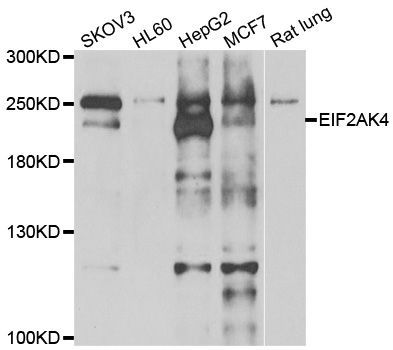 Western blot - EIF2AK4 antibody (144-07155)