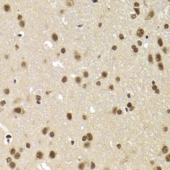Immunohistochemistry - SNRPA Antibody (144-06410)