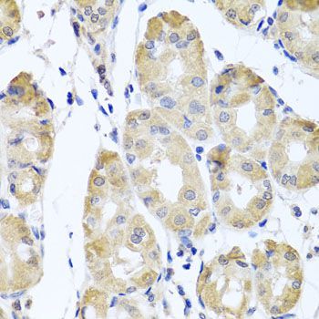 Immunohistochemistry - CBR4 antibody (144-05069)