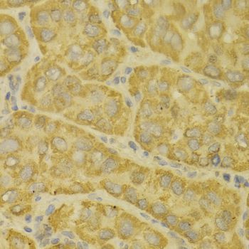 Immunohistochemistry - MAOA antibody (144-01354)