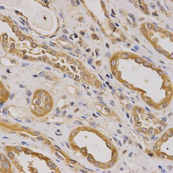 Immunohistochemistry - ARHGAP25 antibody (144-01223)