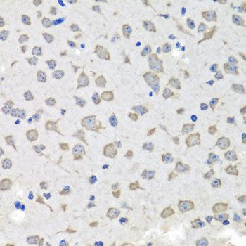 Immunohistochemistry - C1GALT1C1 antibody (144-07590)