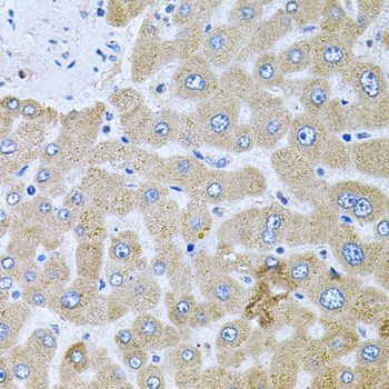 Immunohistochemistry - POMGNT1 antibody (144-09879)