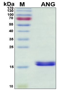 SDS-PAGE