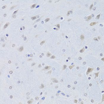 Immunohistochemistry - CBX8 Polyclonal Antibody (144-06222)
