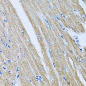 Immunohistochemistry - CCM2 antibody (144-06544)