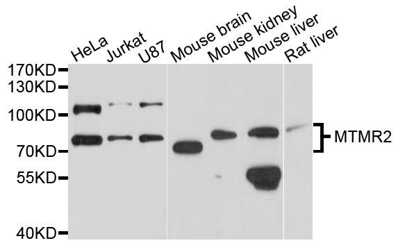 Western blot - MTMR2 antibody (144-08993)