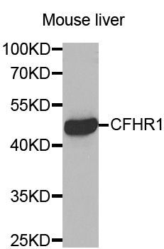 Western blot - CFHR1 antibody (144-02743)