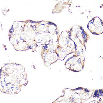 Immunohistochemistry - IGF2R Polyclonal Antibody (144-60151)