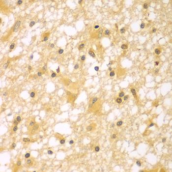 Immunohistochemistry - PAK6 antibody (144-07821)