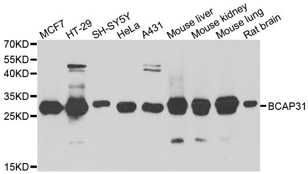 Western blot - BCAP31 Polyclonal Antibody (144-07056)