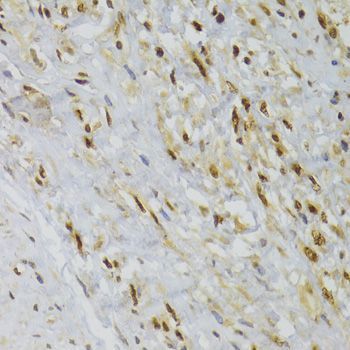 Immunohistochemistry - HNRNPA1 Polyclonal Antibody (144-07491)