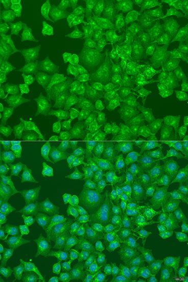 Immunofluorescence - DCP2 antibody (144-08282)