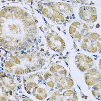 Immunohistochemistry - PMPCB antibody (144-04312)