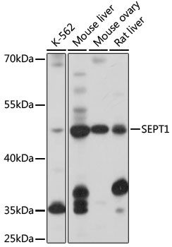 Western blot