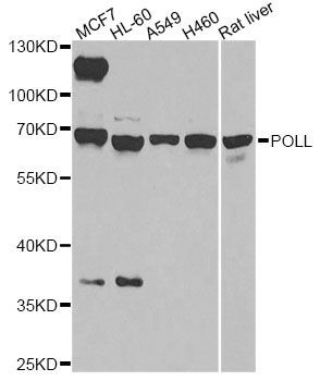 Western blot - POLL antibody (144-08408)