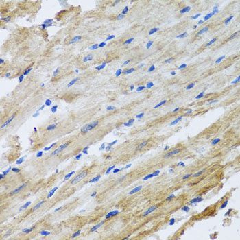 Immunohistochemistry - SNAP29 antibody (144-04290)