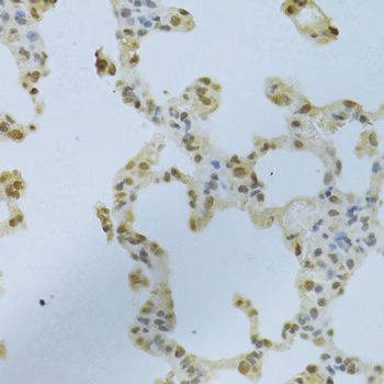 Immunohistochemistry - HNRNPK Antibody (144-01701)