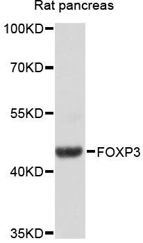 Western blot - FOXP3 Polyclonal Antibody (144-012051)